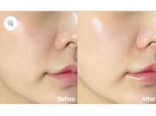 Load image into Gallery viewer, Dermathod Priming Peel Pads