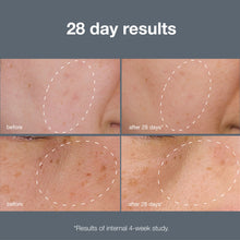 Load image into Gallery viewer, powerbright dark spot system
2-step system visibly lifts + fades dark spots