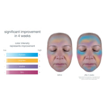 Load image into Gallery viewer, smart response serum