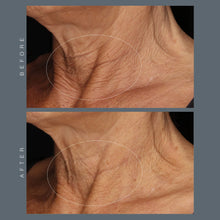 Load image into Gallery viewer, neck fit contour serum