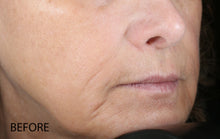 Load image into Gallery viewer, biolumin-c vitamin c serum