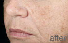 Load image into Gallery viewer, retinol clearing oil 30ml