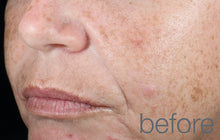 Load image into Gallery viewer, retinol clearing oil 30ml