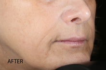 Load image into Gallery viewer, biolumin-c vitamin c serum
