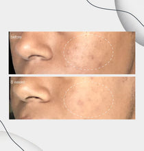 Load image into Gallery viewer, powerbright dark spot serum