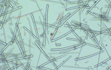 Load image into Gallery viewer, Dermathod O2 Tox Peel (Spicule Peel Serum) New Formula
