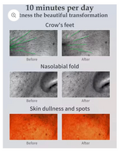 Load image into Gallery viewer, Seoulogy Skin Brightening LED Mask
