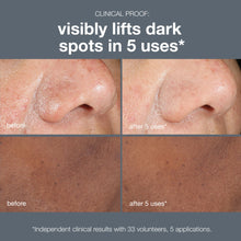 Load image into Gallery viewer, powerbright dark spot peel

visibly lifts hyperpigmentation 50ml
